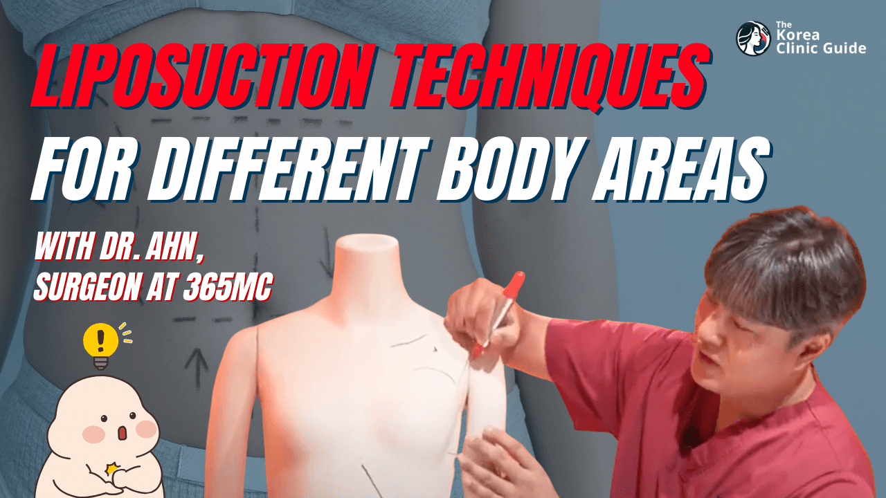 Full Body Liposuction in Korea & Liposuction Techniques For Different Body Areas - 365mc Clinic
