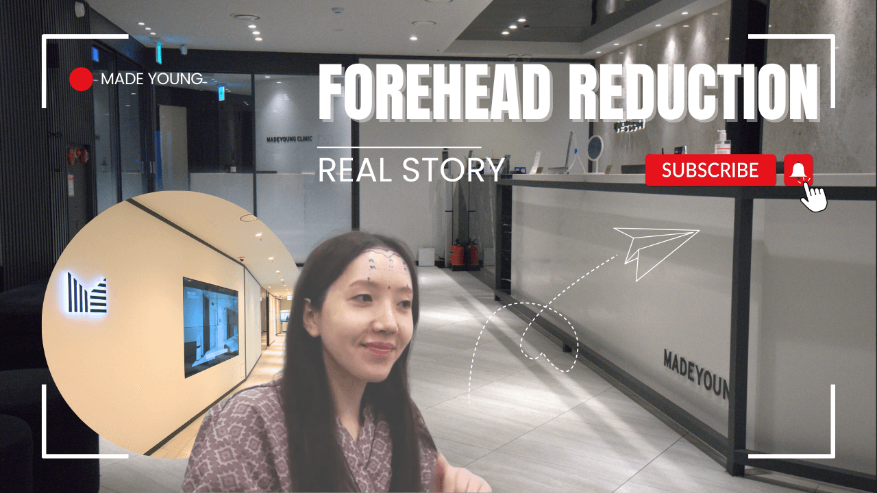 Forehead Reduction in Korea │ Forehead Lifting at Made Young Clinic in Seoul