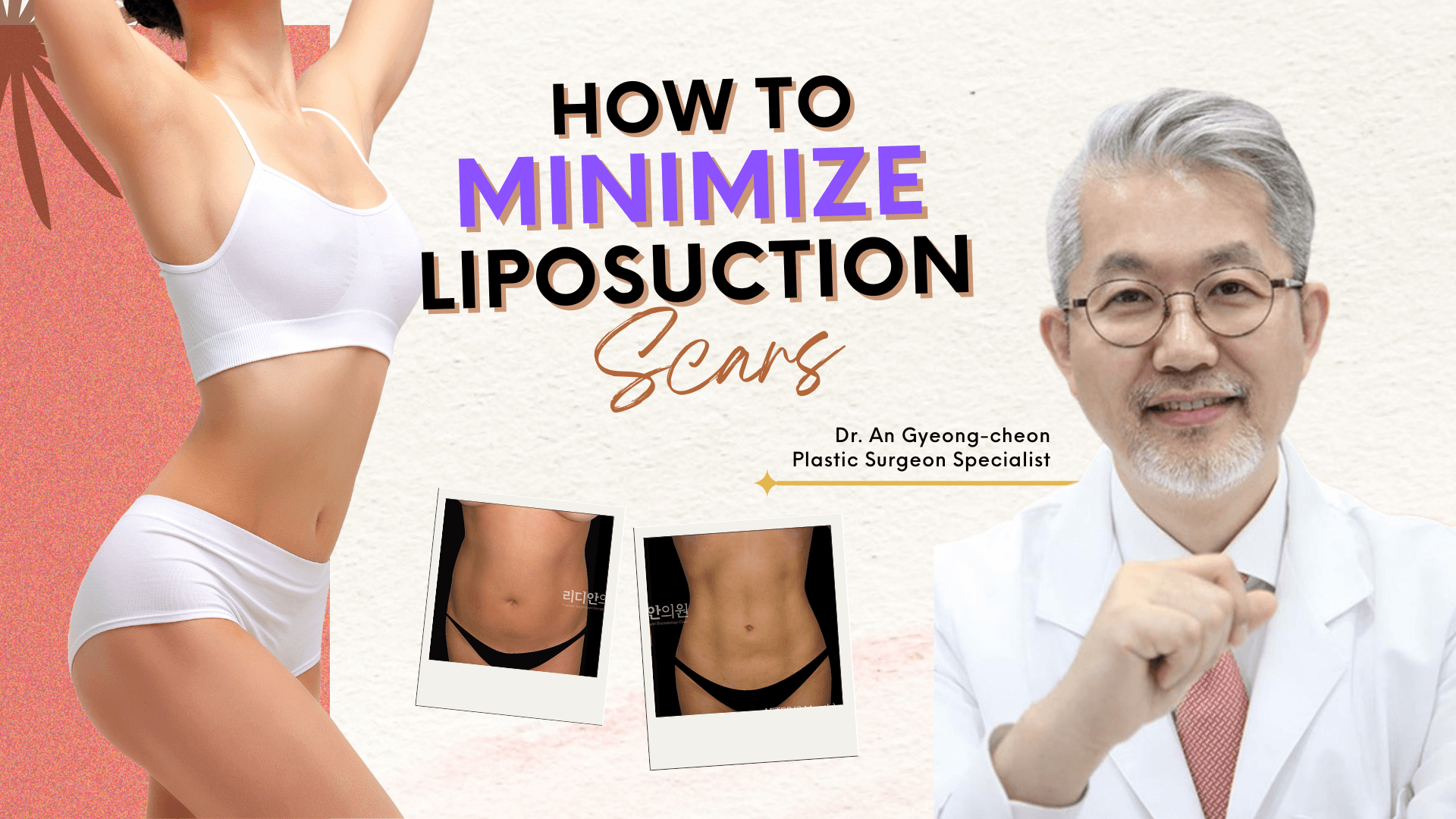 Dr. An Q&A Liposuction scars - Lydian