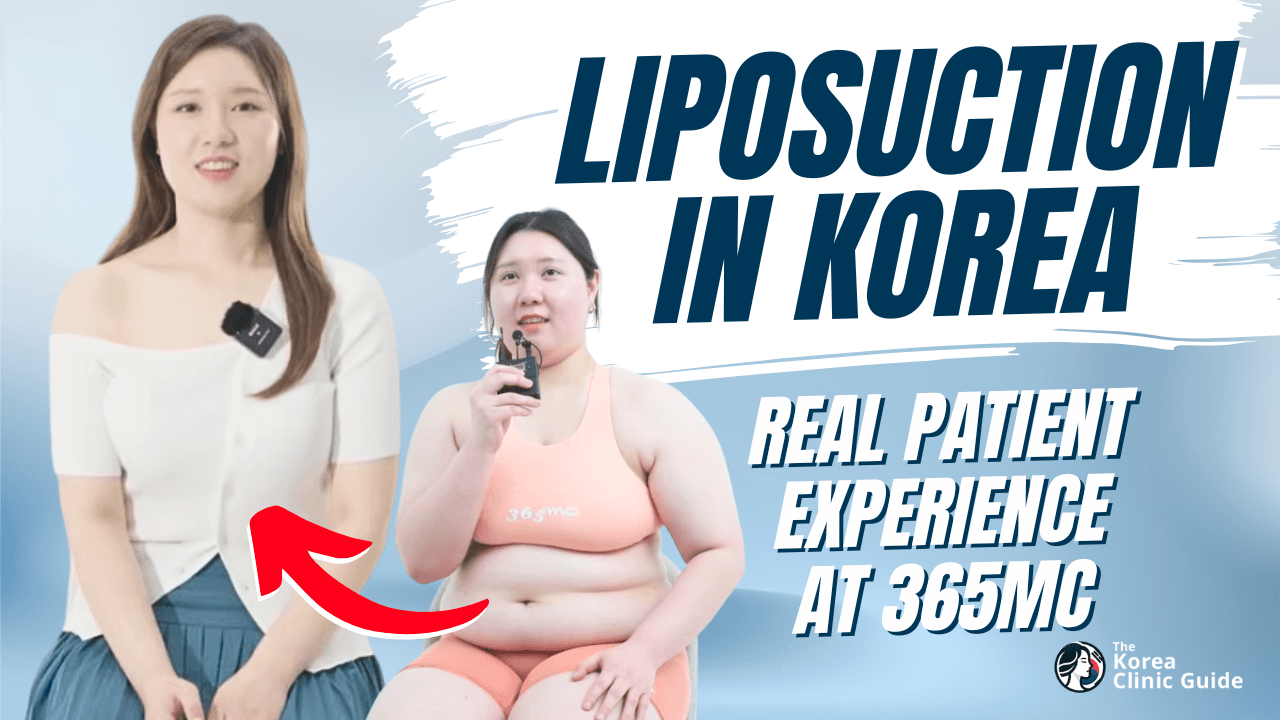 Liposuction in Korea | Real Patient Interview at 365 mc in Seoul