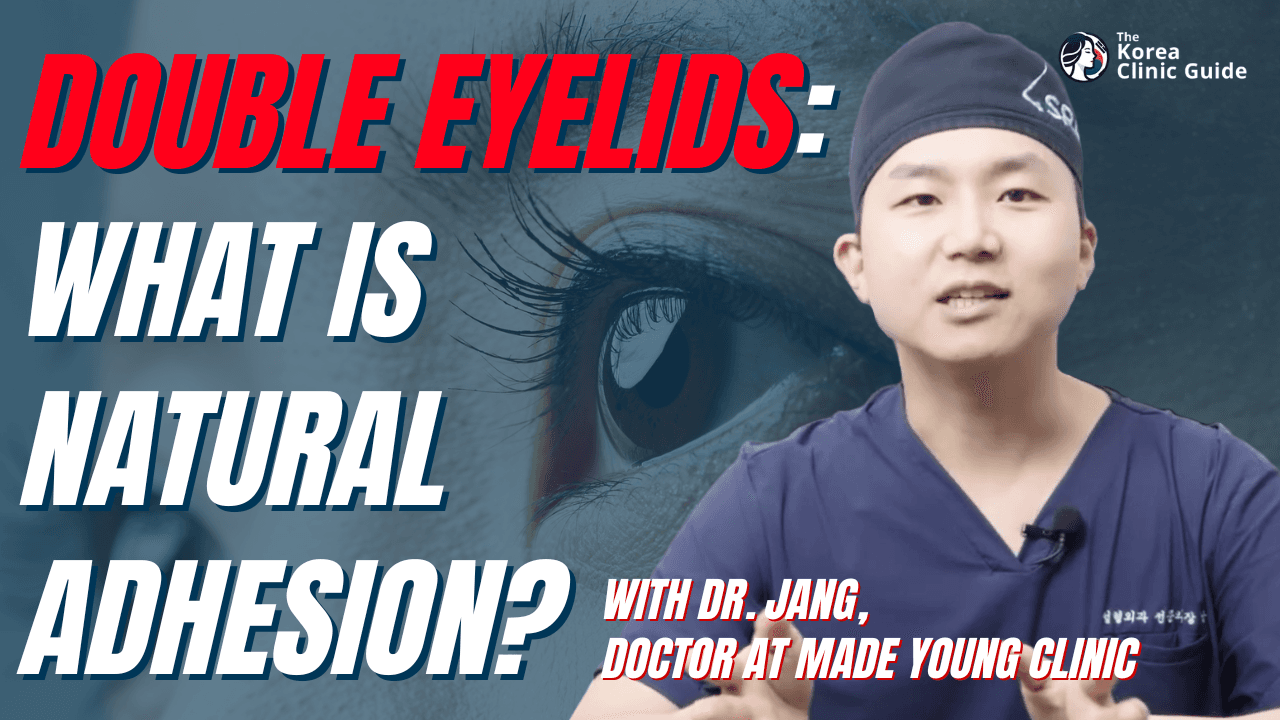 Doppellid-OP: Was ist die Natural-Adhesion-Methode und warum ist sie so beliebt? Mit Dr. Park von MadeYoung