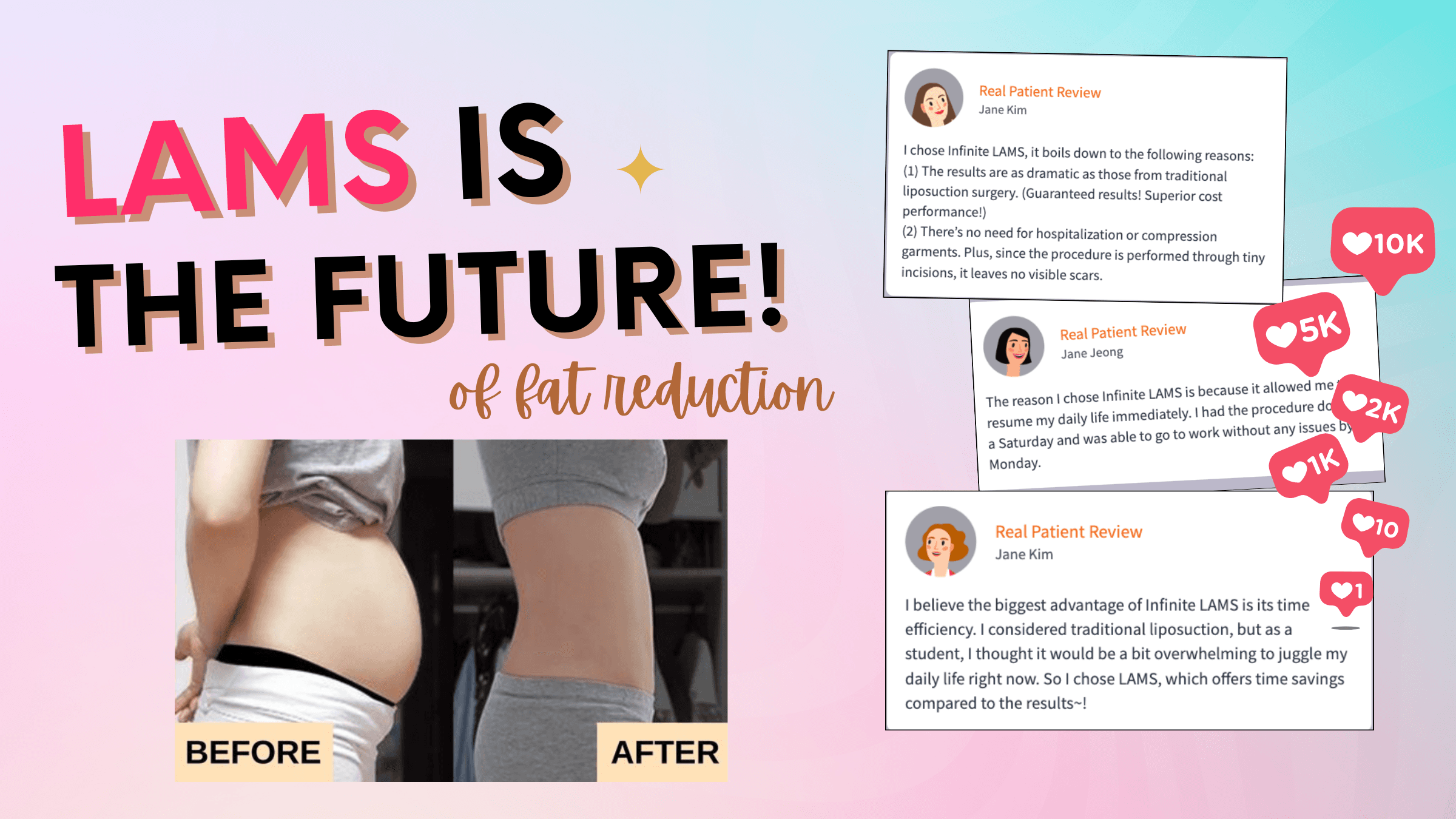 LAMS Liposuction is the Future of Fat Reduction: Costs, Clinics & Benefits