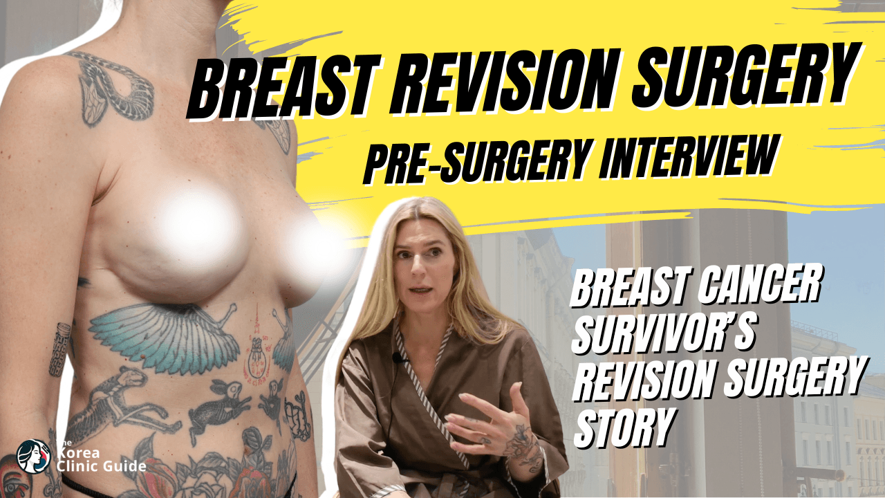 Breast Revision Surgery in Korea After Breast Cancer│Real Patient Interview at Seojin Clinic