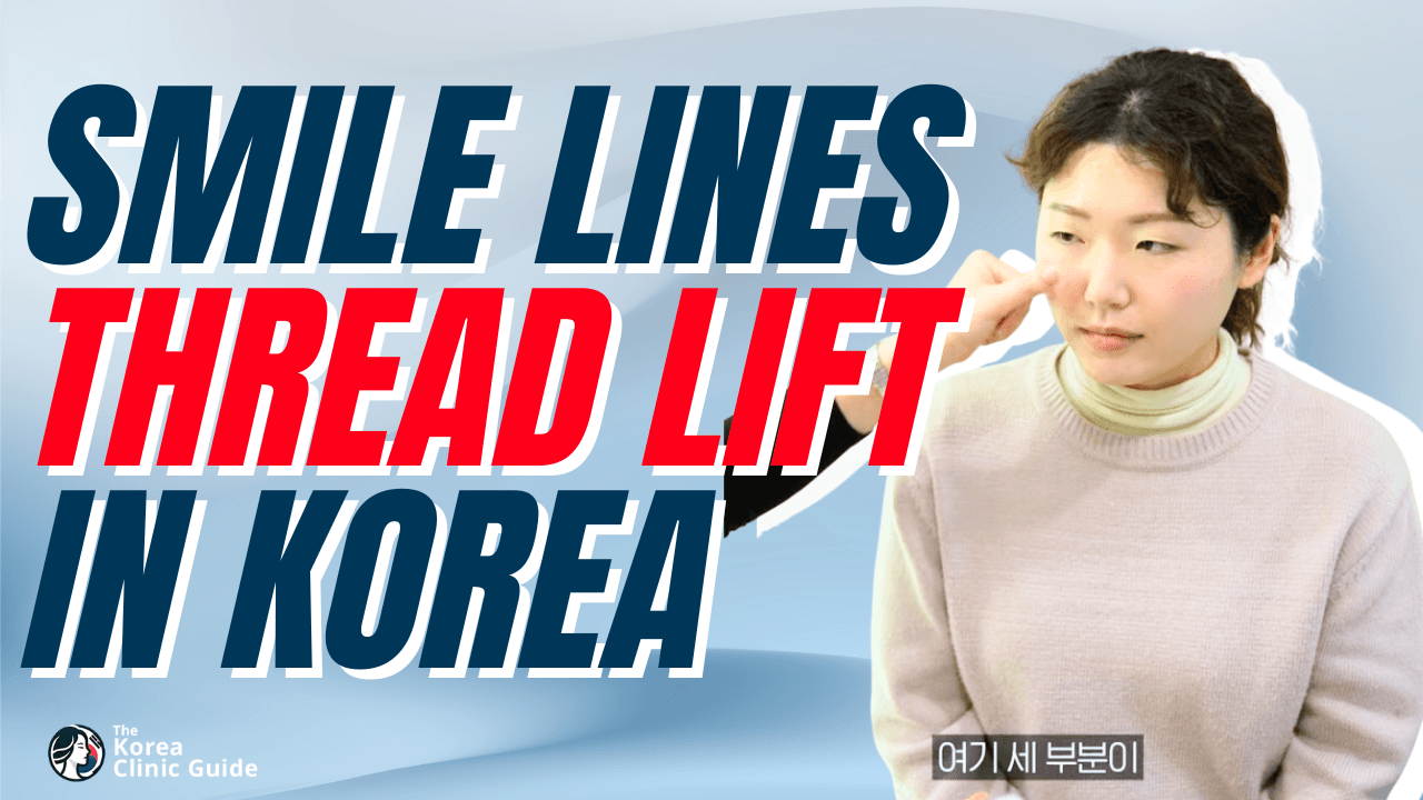 Smile Lines Thread Lift in Korea at PangPang Clinic in Seoul