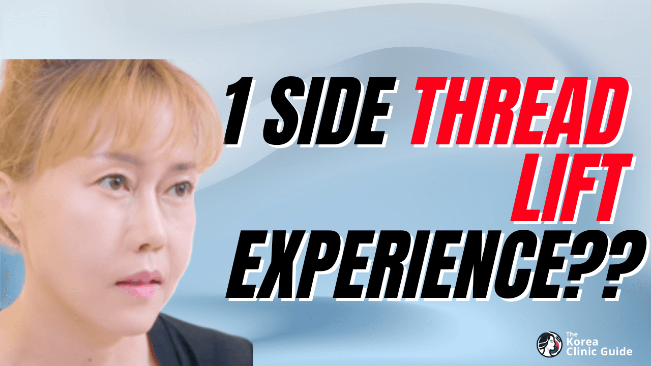 One Side Thread Lift vs The Other… Shocking Difference