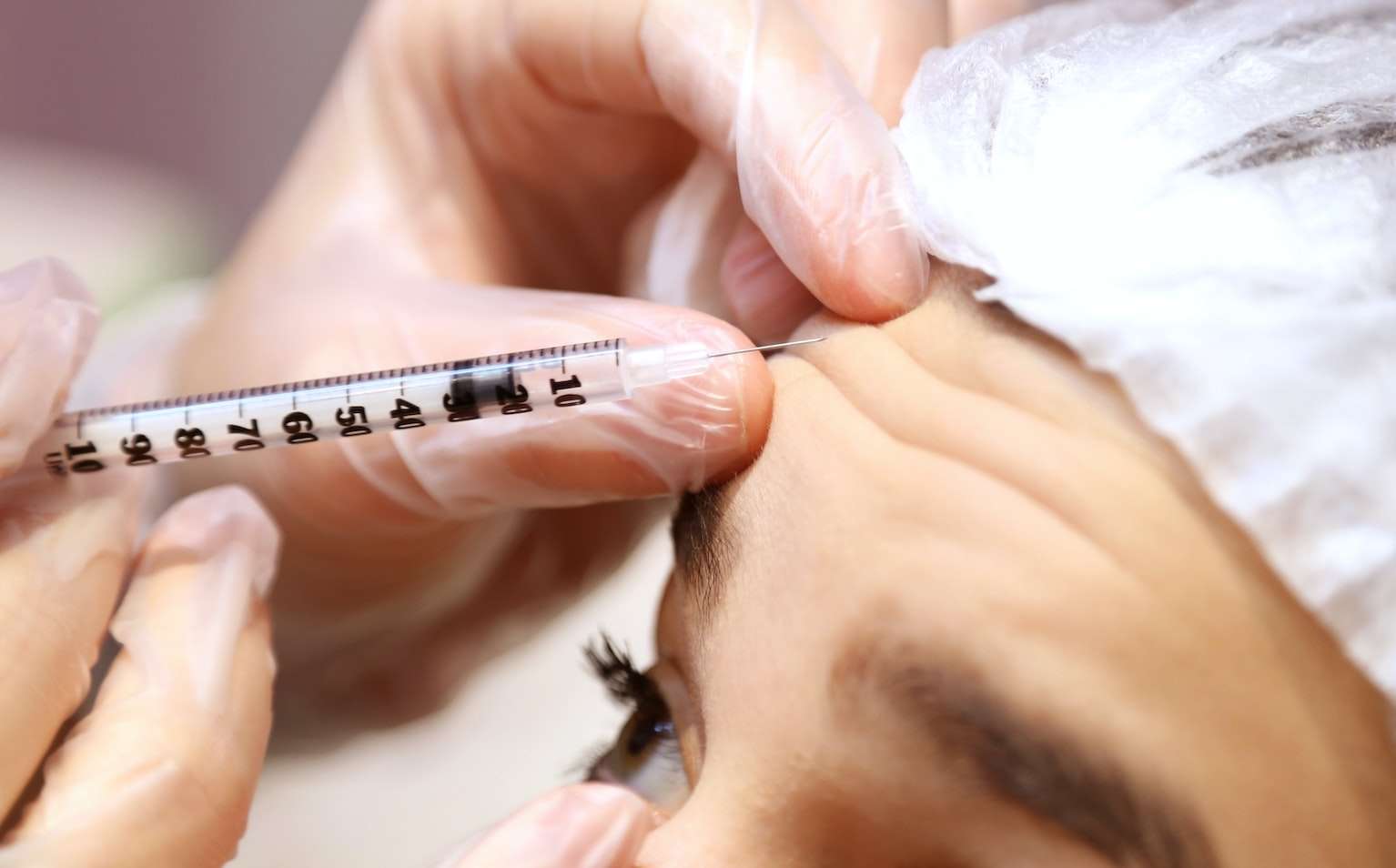 Botox in Korea | Die besten Kliniken für Botox, Kosten, Behandlungsarten und mehr!