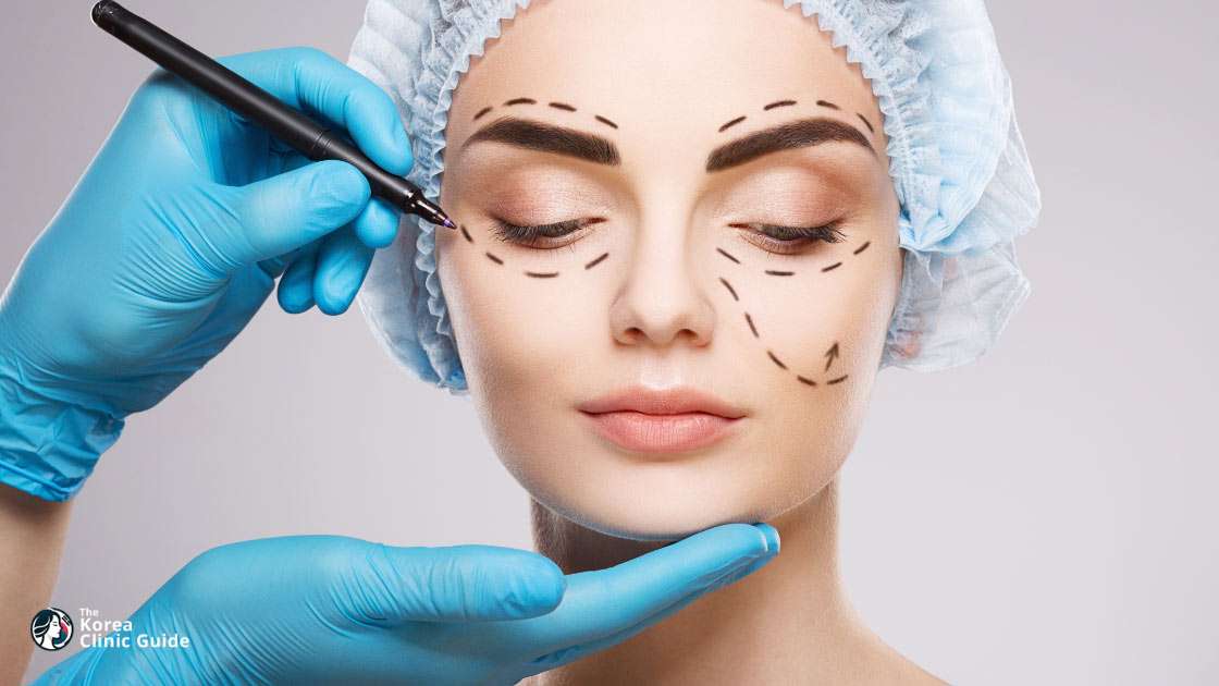 Entfernung oder Umverlagerung von Fett am Unterlid in Korea | Die besten Kliniken, Kosten, Behandlungsarten und mehr