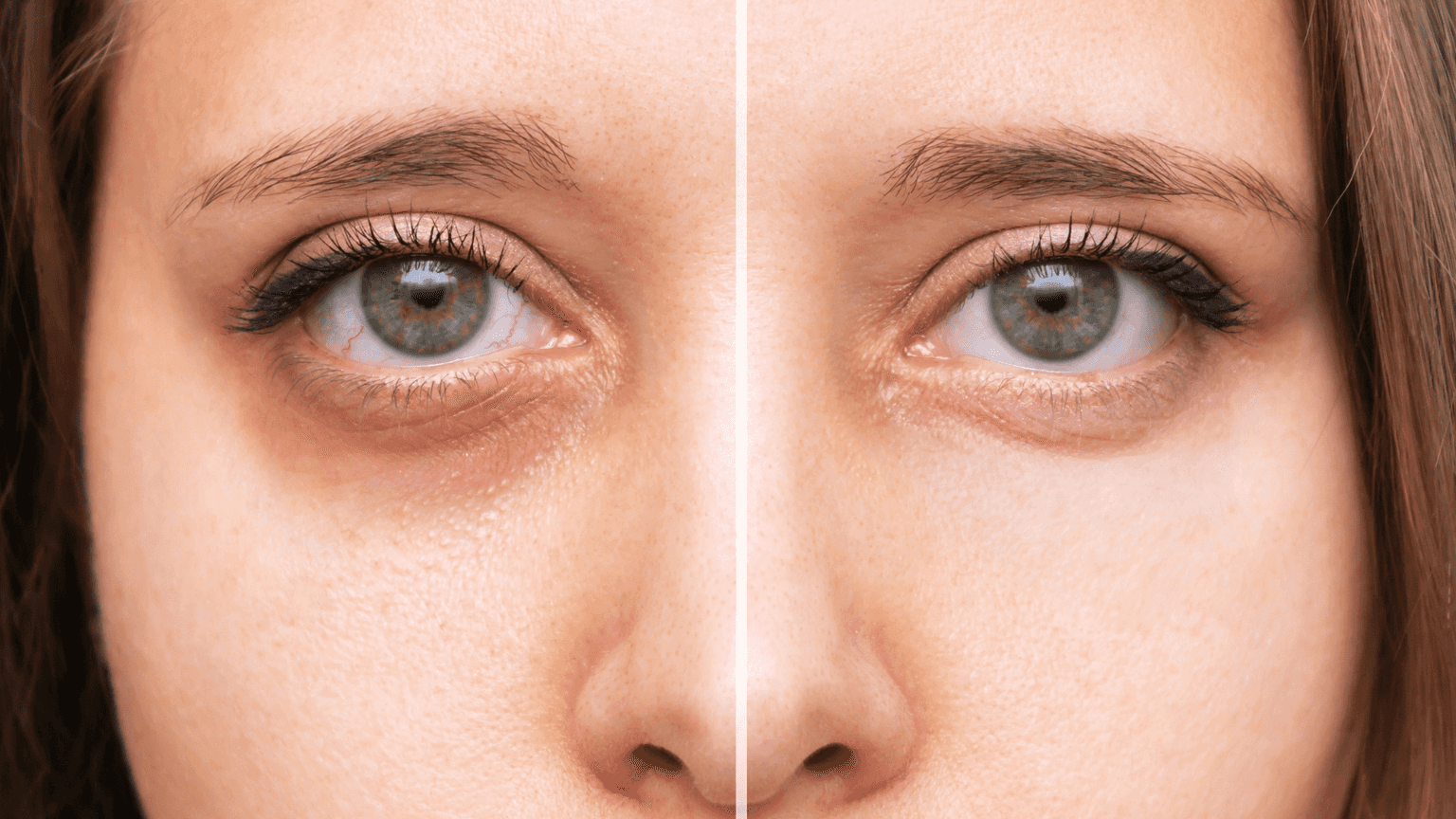 Facial Filler in Korea | Best Clinics, Costs, Procedure Types & More