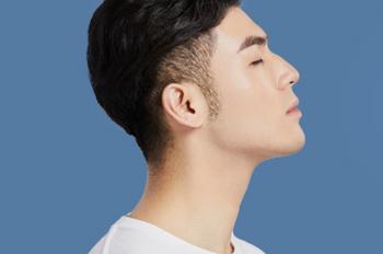 Mo & Bless Hair Transplantation Center