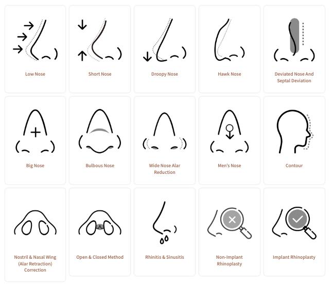 Rhinoplasty