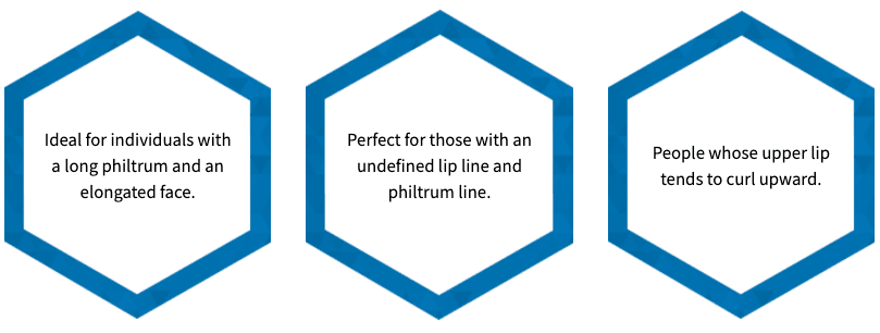Philtrum Reduction Surgery