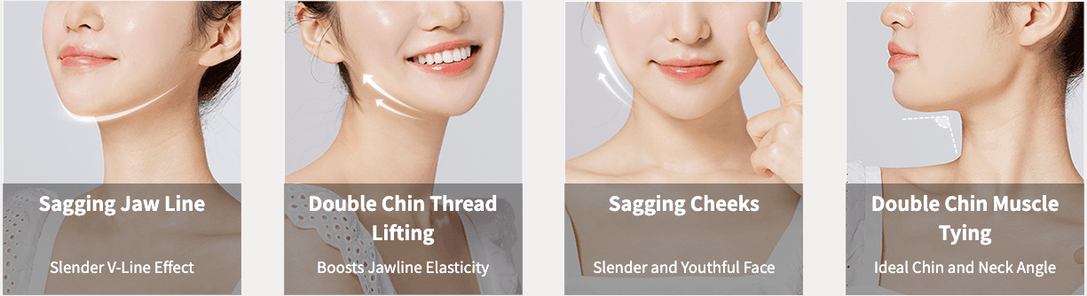 Double Chin Tightening