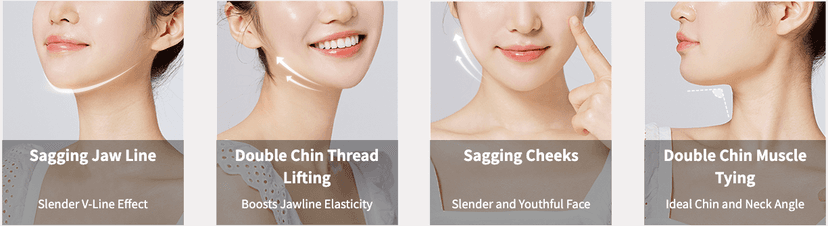 Double Chin Threading Discover South Korea's Competitive Edge: Double Chin Tightening Cost ...