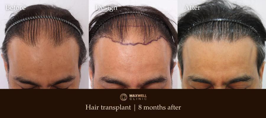 Male frontal