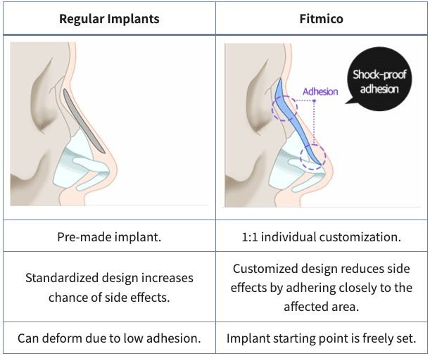 Nose Implant