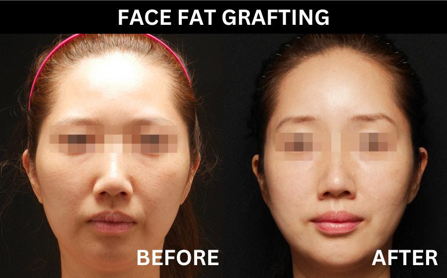 Lydian Plastic Surgery Clinic before and after image