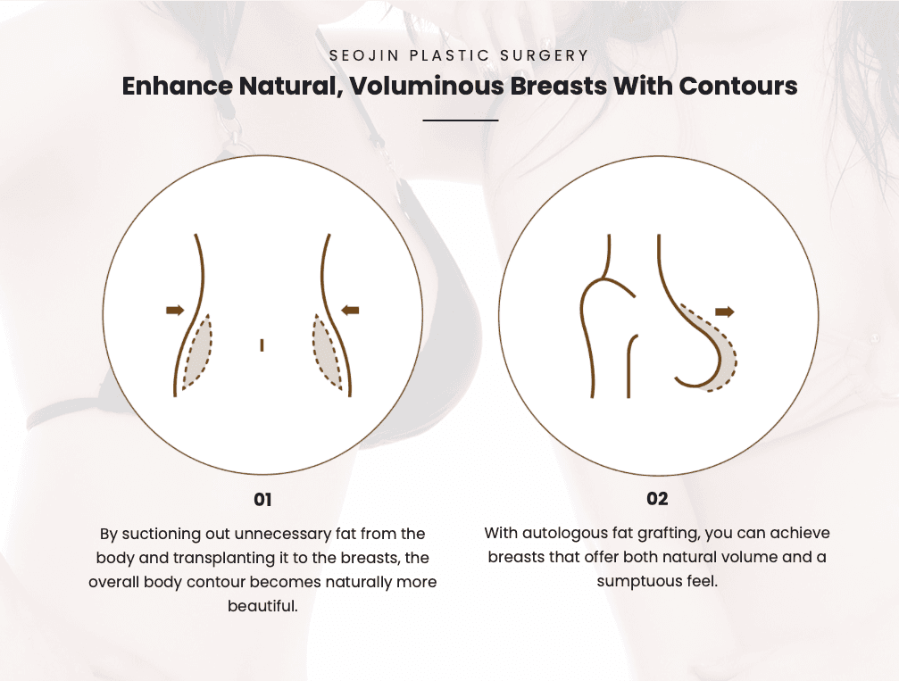 Breast Fat Grafting