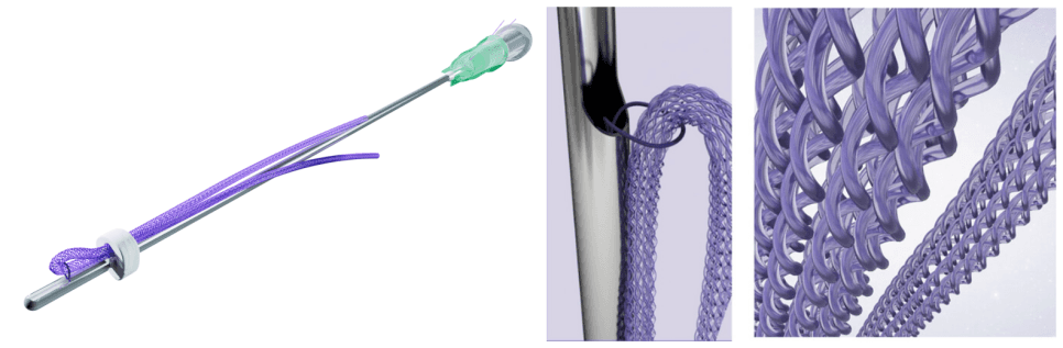 Filling Threads