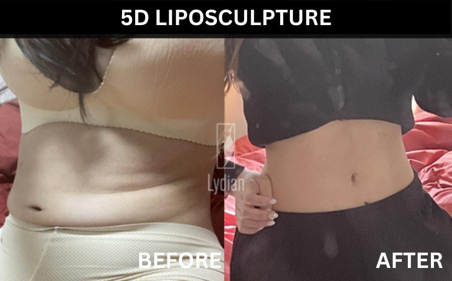 Lydian Plastic Surgery Clinic before and after image