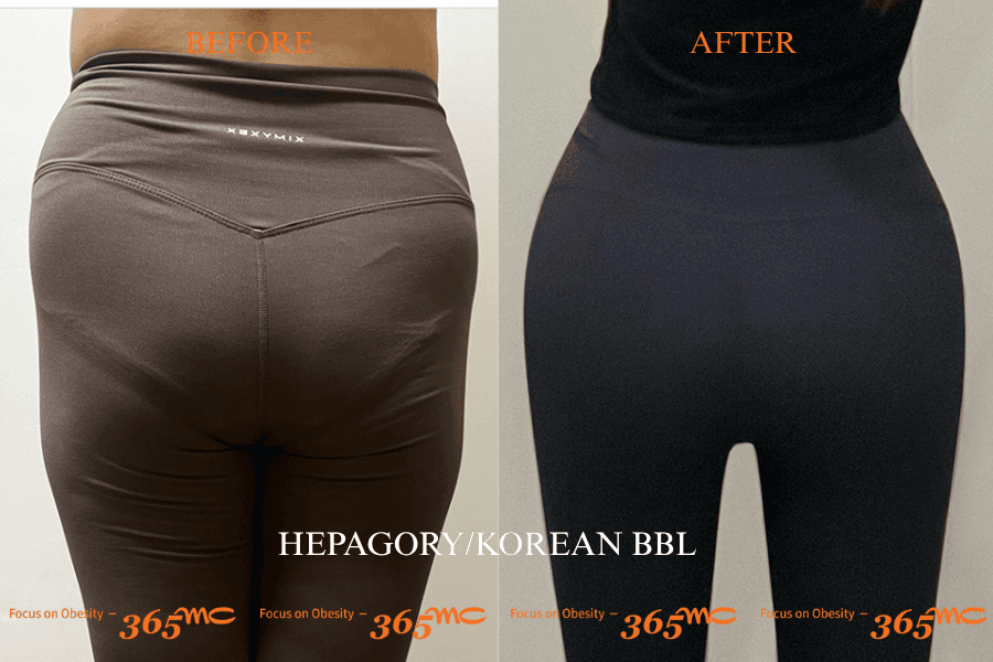 Korean BBL