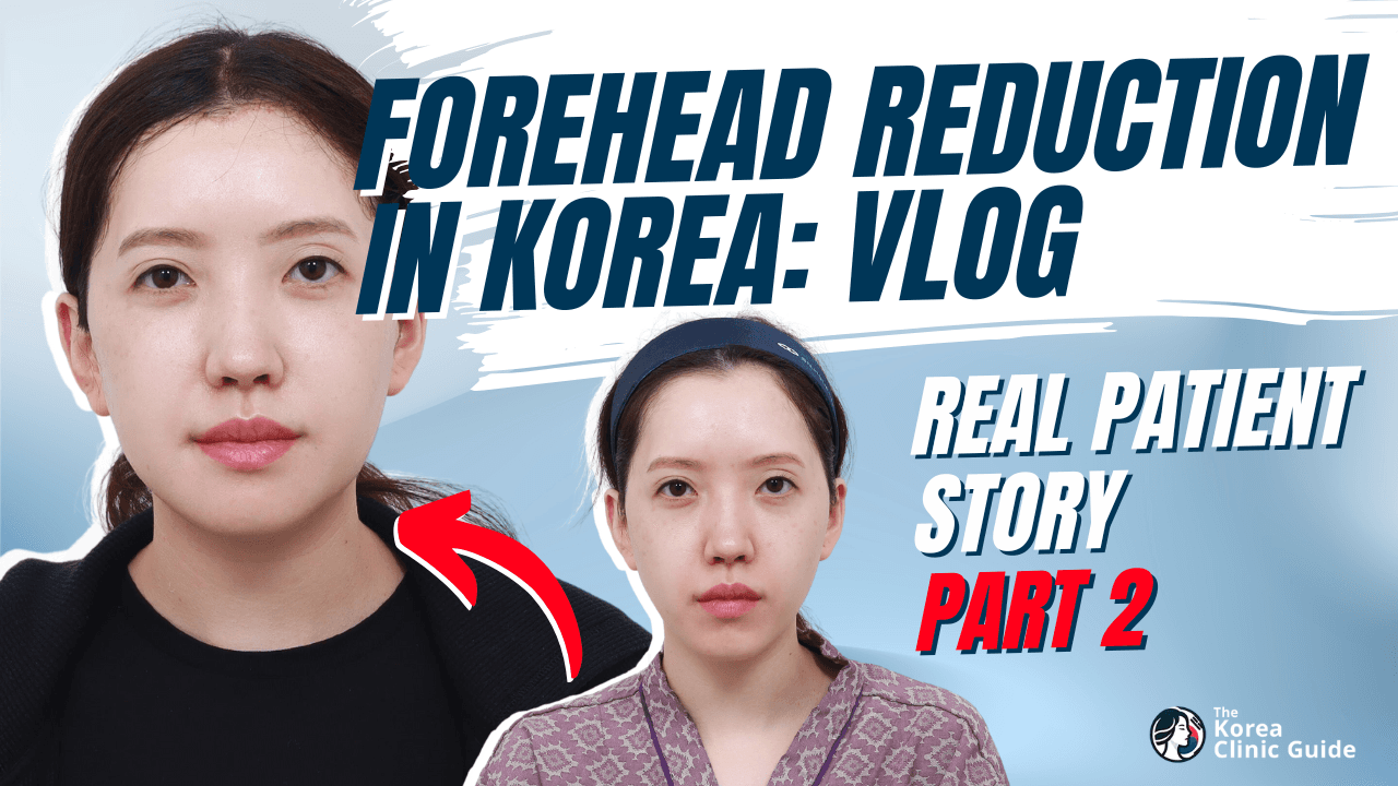 Forehead Reduction pt 2 in Korea Before & After│Real Patient Results From Made Young Clinic in Korea