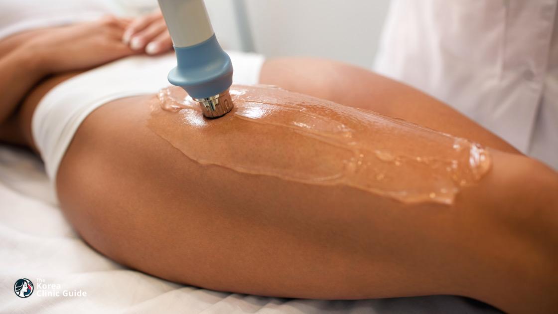 Shockwave Therapy for Fat Dissolving in Korea: Methods, Results, Safety, and Travel Planning