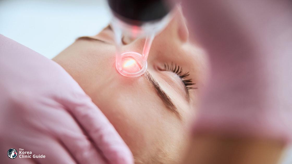 CO2 Laser in Korea: Resurfacing Methods, Recovery, Risks and Travel Planning