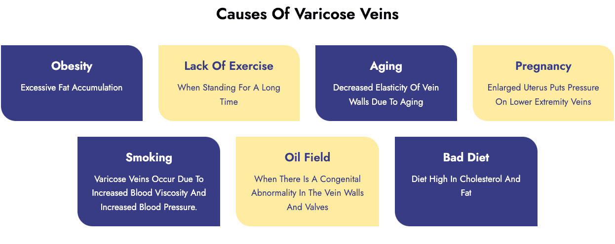 Varicose Vein Treatment