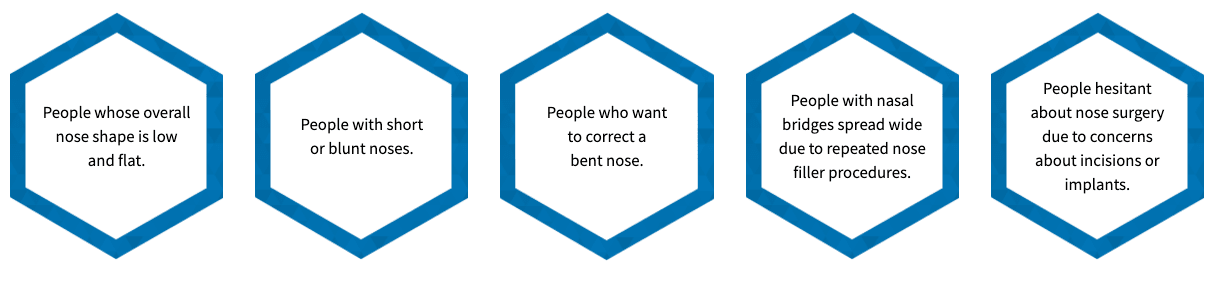 Nose Thread Lift