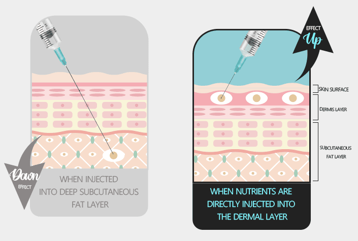 Skin Booster, Skin Booster Exosome