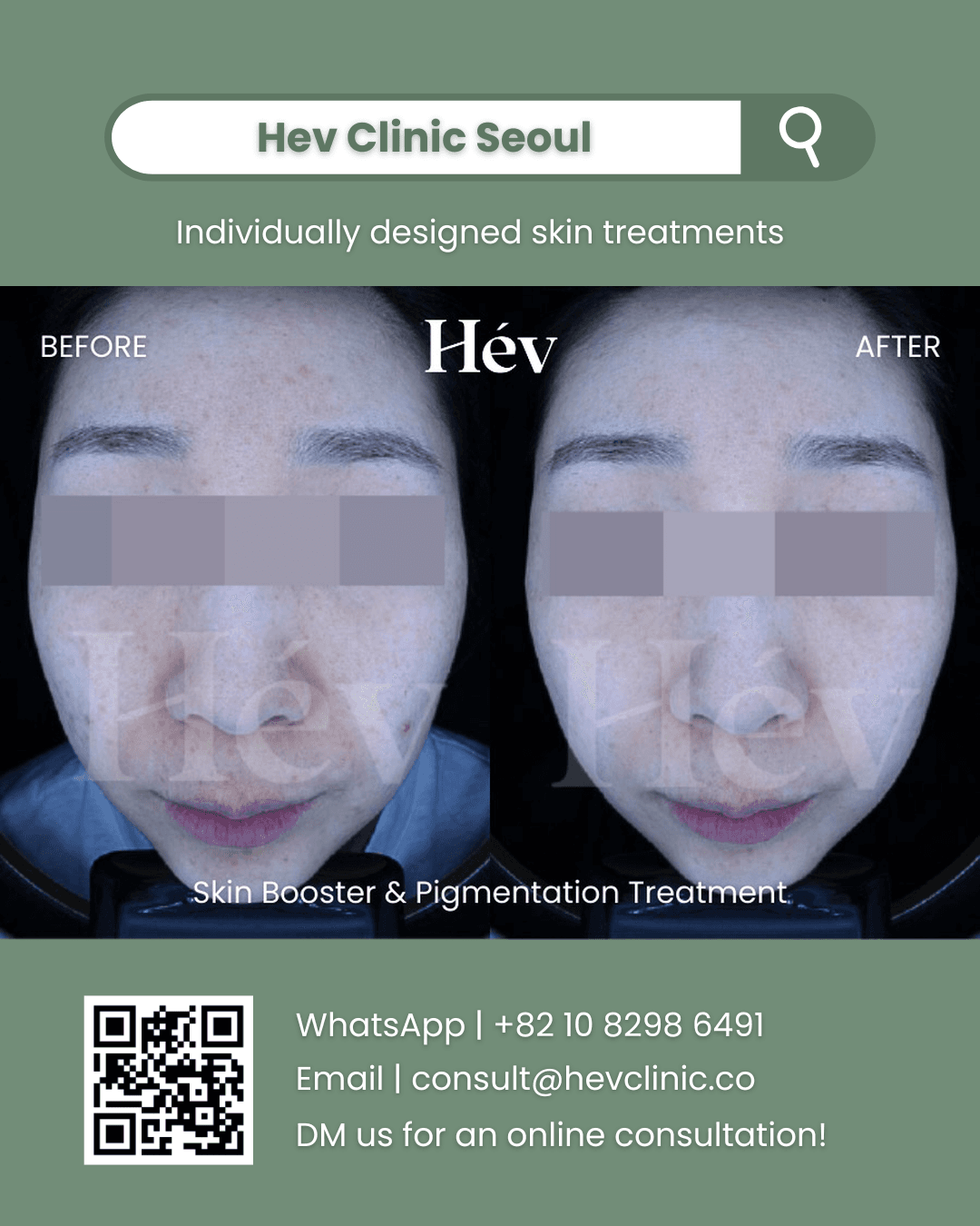 Pigmentation Treatment, Skin Booster