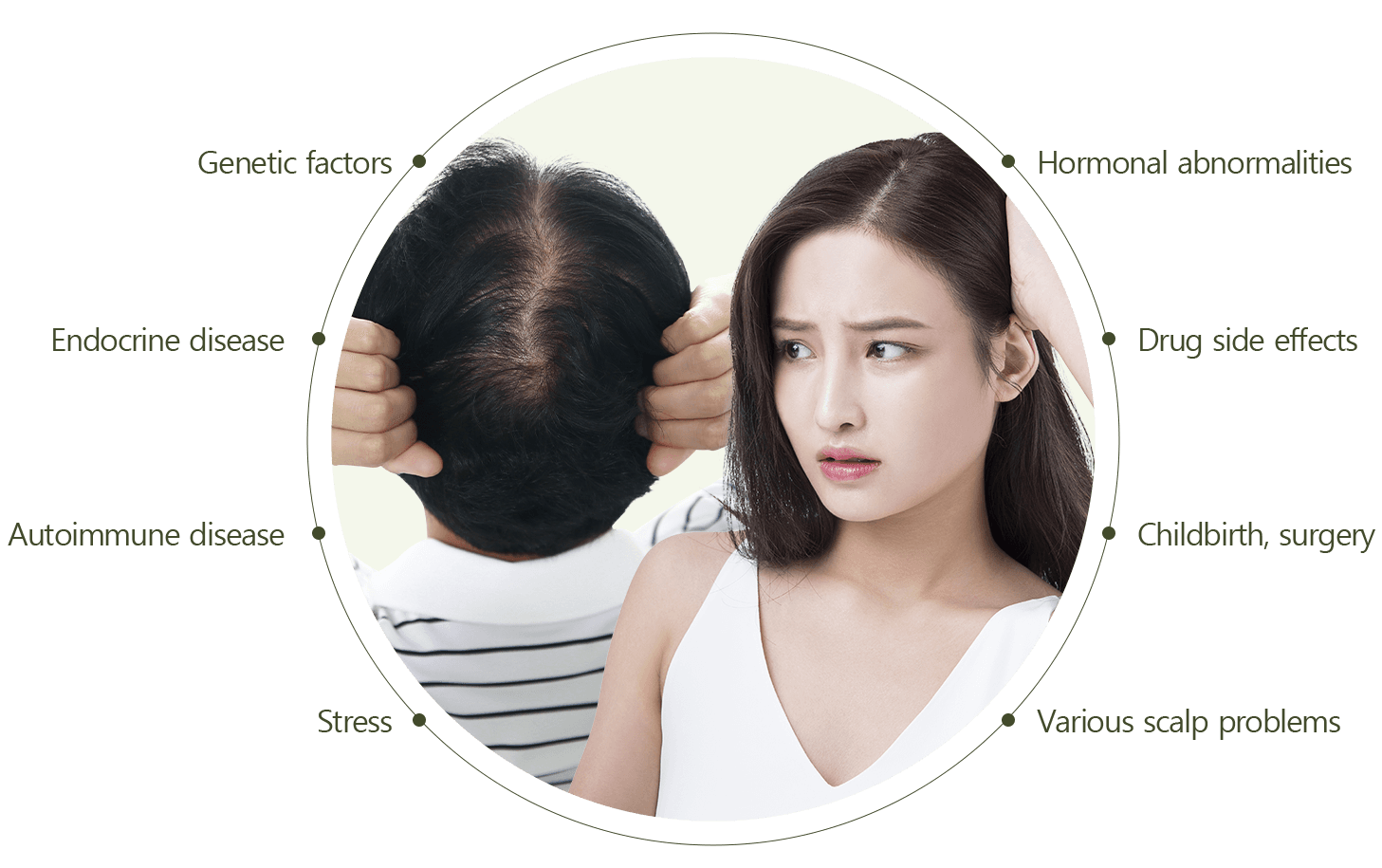 Hairline Correction, Hair Transplant, Hair Loss Treatment