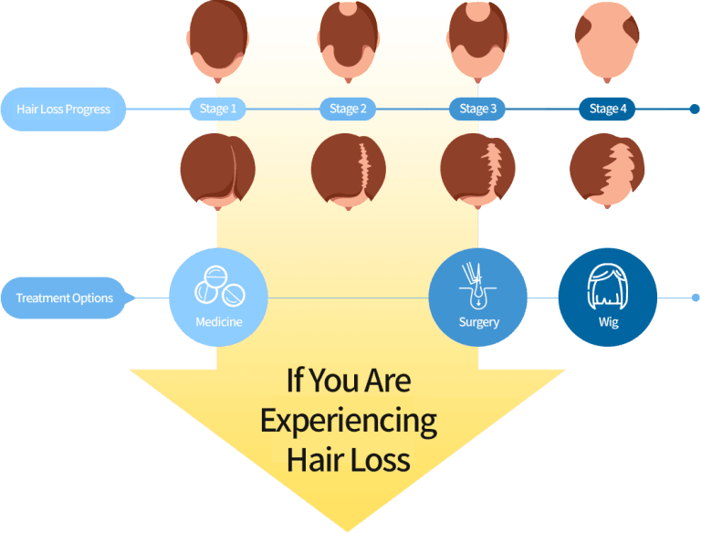 Hair Loss Treatment, Stem Cell Hair Treatment, Stem Cell Scalp Therapy